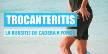 Trocanteritis - Síntomas, diagnóstico y tratamiento