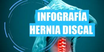 Infografía de Hernia discal