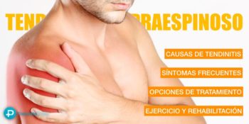 Tendinitis del supraespinoso - Hombro doloroso