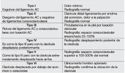 Grados de esguince o luxación acromioclavicular - Rockwood