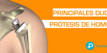 Preguntas sobre la prótesis de hombro