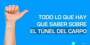 Todo lo que tienes que saber sobre el túnel carpiano