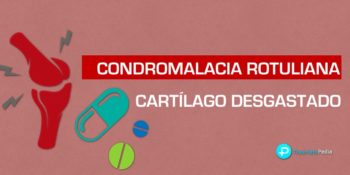 ▷ Condromalacia rotuliana y cartílago de rodilla desgastado