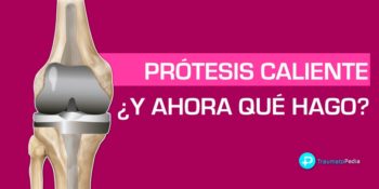 Calor en la prótesis de rodilla - ¿Tengo una infección?