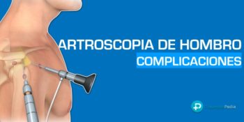 Complicaciones de la artroscopia de hombro