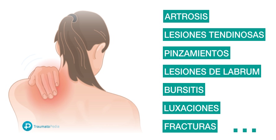 causas más frecuentes de dolor hombro