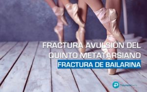 fractura avulsión quinto metatarsiano bailarina