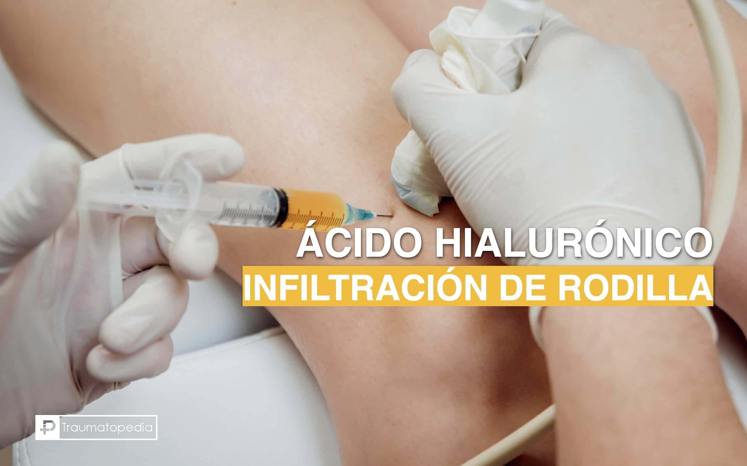 infiltración de rodilla acido hialuronico